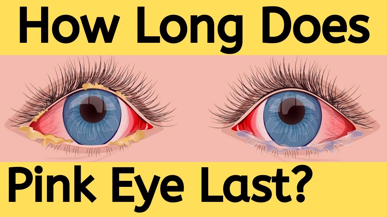 How long does pink eye last