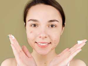 How to get rid of pimples?