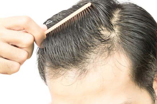 How to stop Hair loss