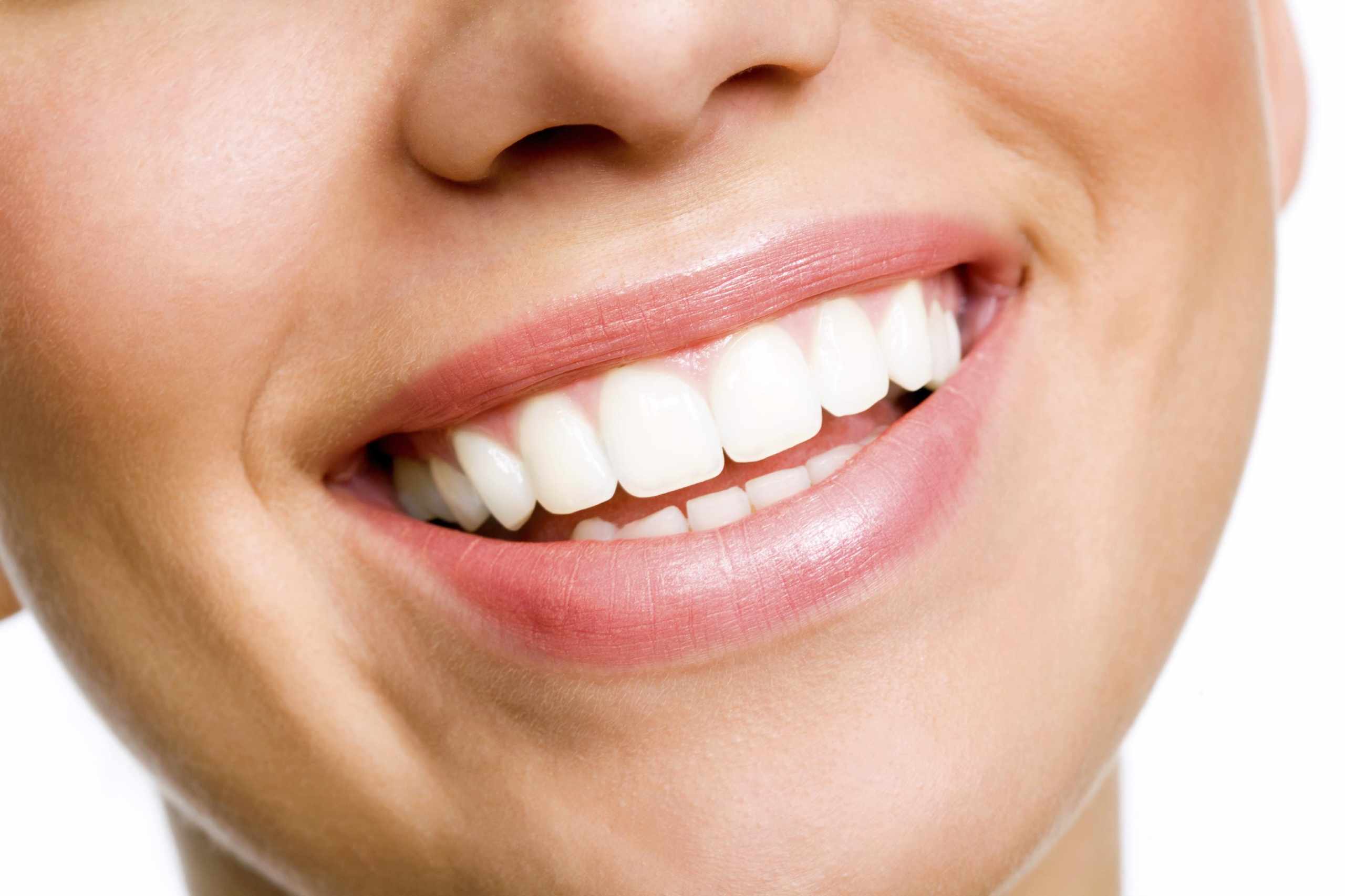 How to whiten teeth?